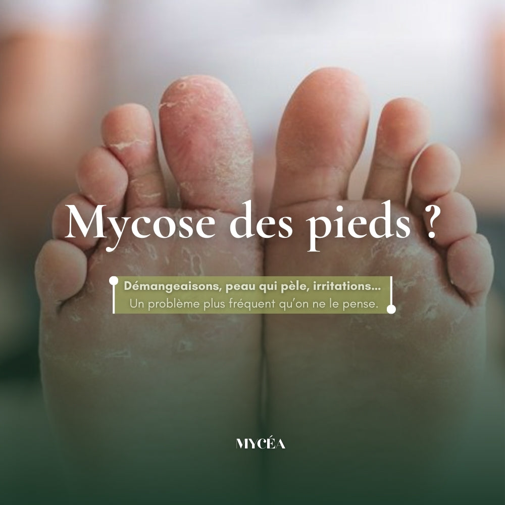 Le savon antifongique qui élimine la mycose des pieds sous la douche.